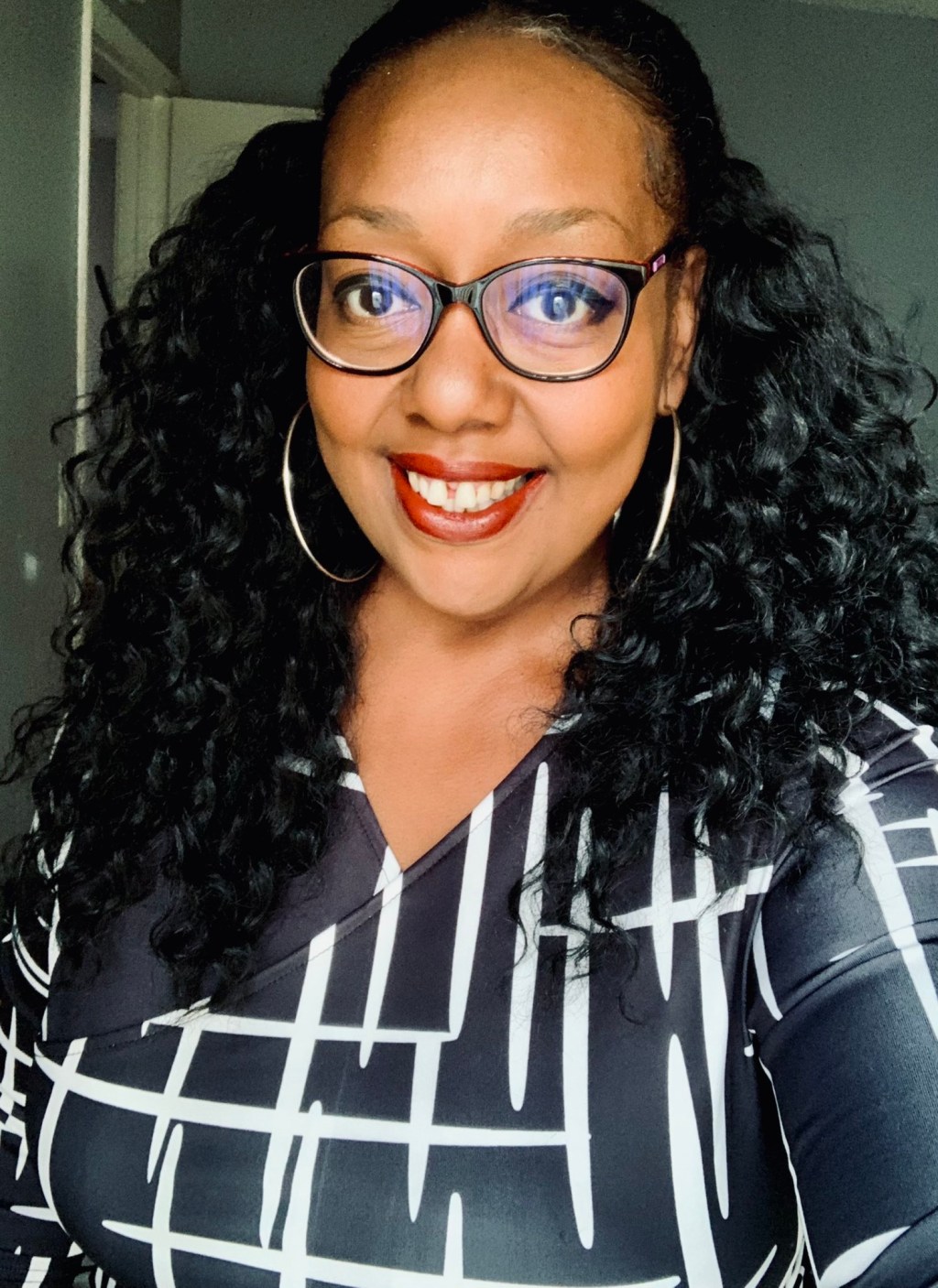 Boiling Water & Sugar to the&nbsp;Face